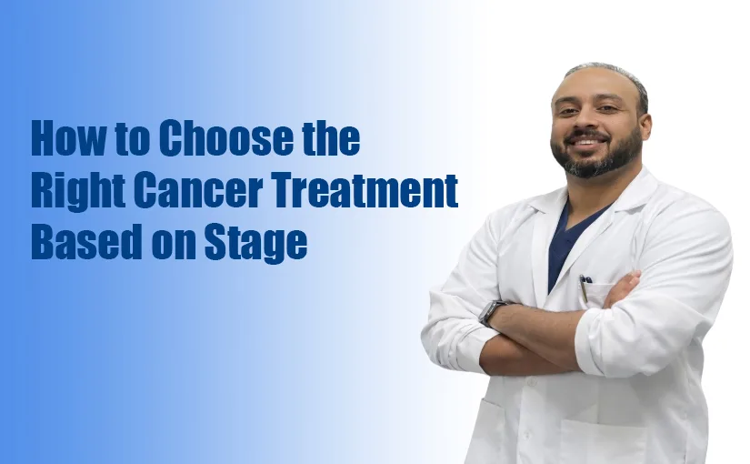 How-to-Choose-the-Right-Cancer-Treatment-Based-on-Stage