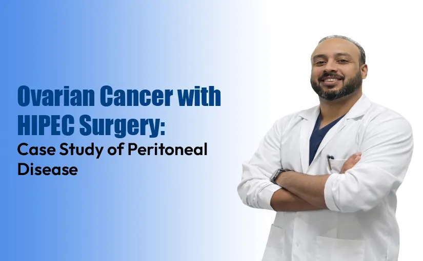 Ovarian-Cancer-with-HIPEC-Surgery-Case-Study-of-Peritoneal-Disease